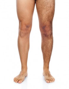 Male hair removal on legs